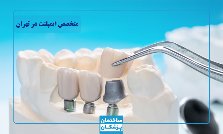 معیارهای مهم در انتخاب بهترین متخصص ایمپلنت در تهران