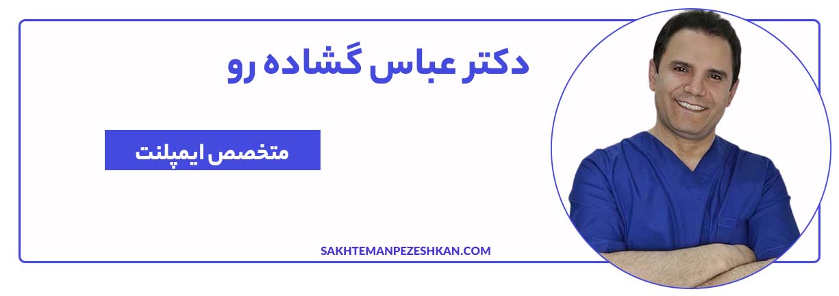 دکتر عباس گشاده رو متخصص ایمپلنت تهران