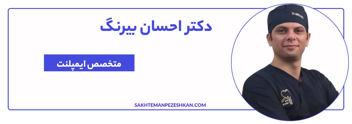 دکتر احسان بیرنگ متخصص ایمپلنت