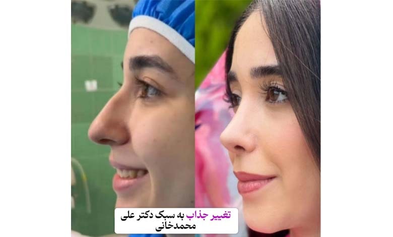 عکس قبل و بعد از عمل بینی دکتر محمدخانی