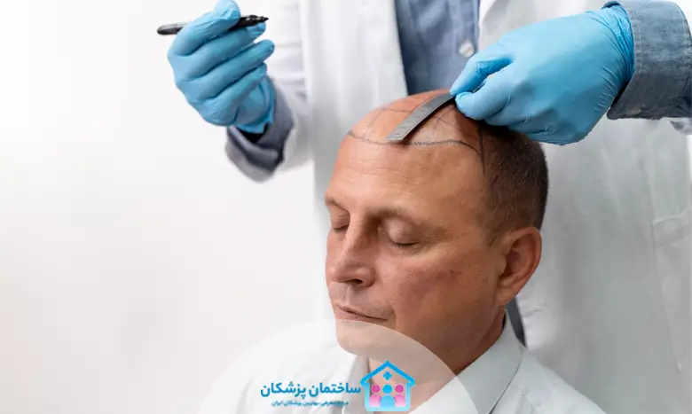 بهترین کلینیک کاشت مو در مشهد