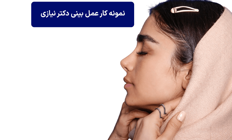 نمونه کار عمل بینی دکتر نیازی