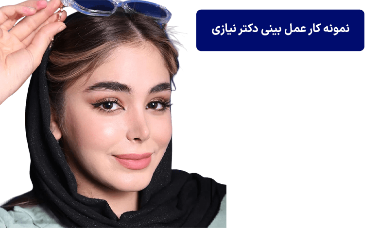 نمونه کار عمل بینی دکتر نیازی