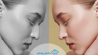 بهترین جراح بینی در مشهد