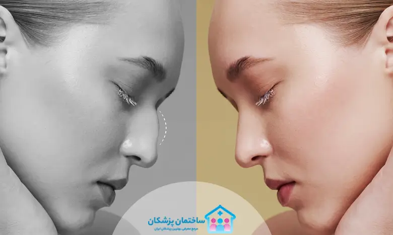 بهترین جراح بینی در مشهد