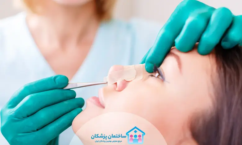 ویژگی های بهترین جراح بینی تهران