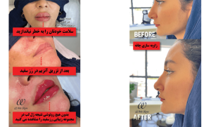 نمونه کارهای زیبایی از کلینیک زیبایی رز سفید