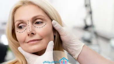 بهترین جراح پلک در اصفهان