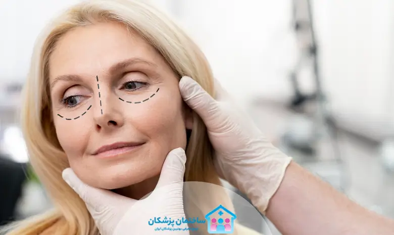 بهترین جراح پلک در اصفهان