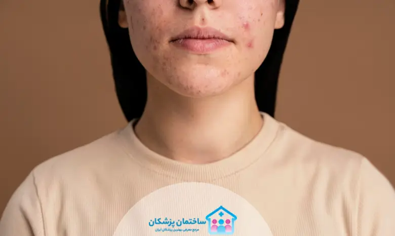 بهترین فوق تخصص پوست در کرج چه بیماری هایی را درمان میکند