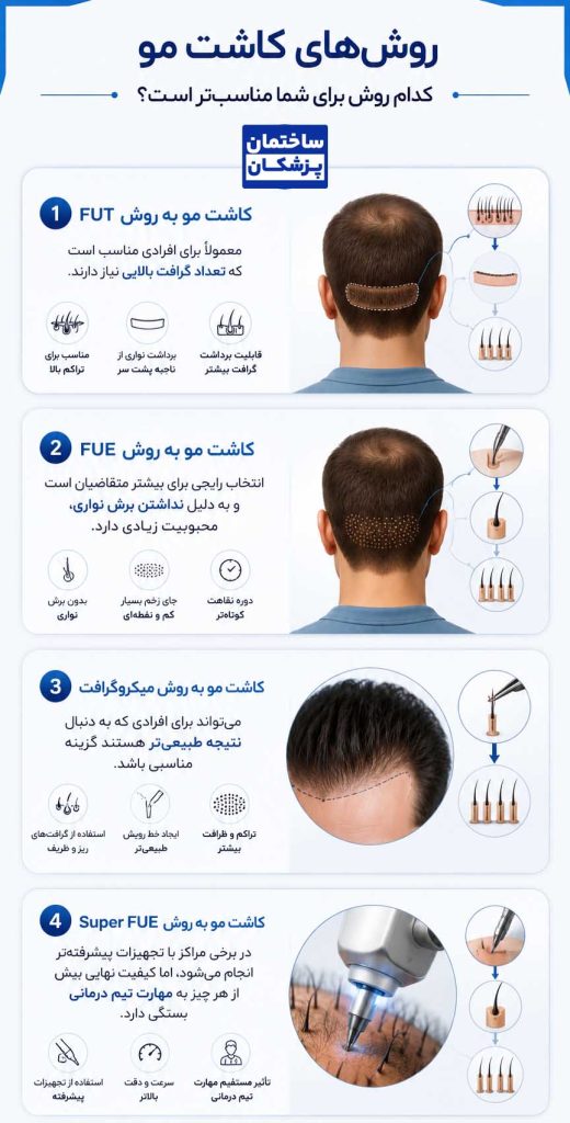بهترین روش کاشت مو در تهران چیست؟