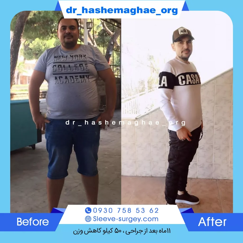 نمونه کار اسلیو هاشم آقایی