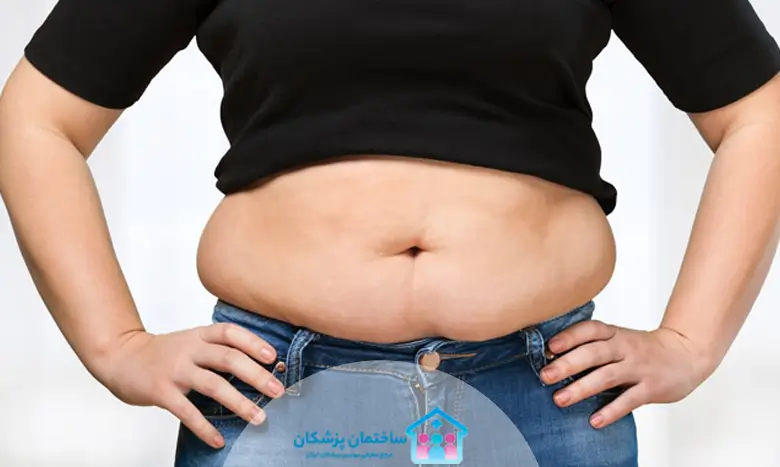 هزینه بای پس معده در تهران