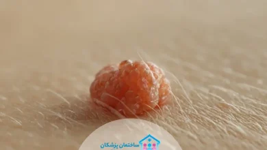 لیست بهترین دکتر زگیل تناسلی در تهران