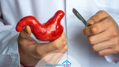 بهترین دکتر اسلیو معده در تهران