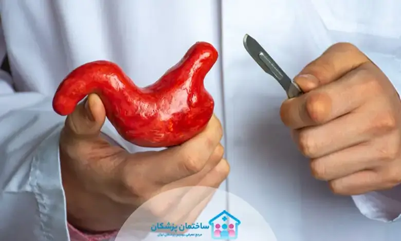 بهترین دکتر اسلیو معده در تهران
