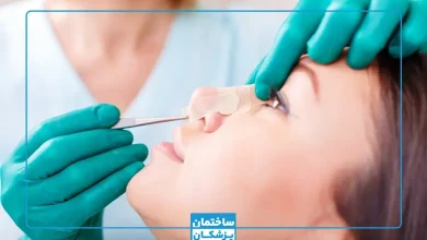 بهترین جراح بینی ترمیمی در تهران چه کسی است؟