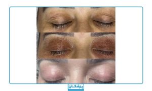 نمونه کار زیبایی کلینیک دلدار4