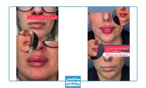 نمونه کار زیبایی کلینیک دلدار5