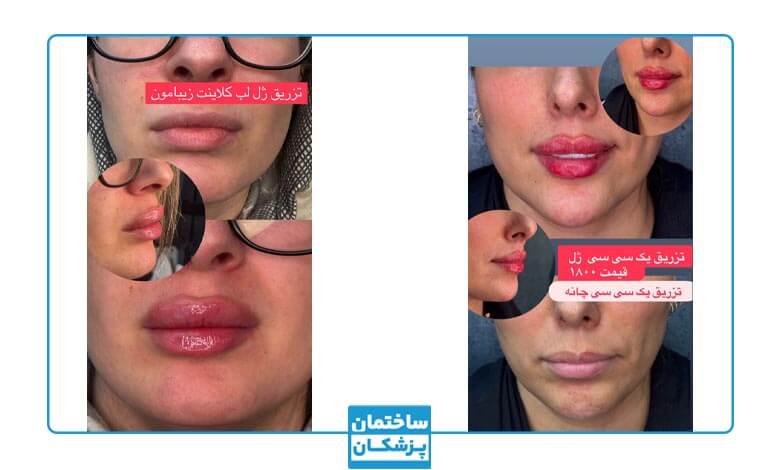 نمونه کار زیبایی کلینیک دلدار5