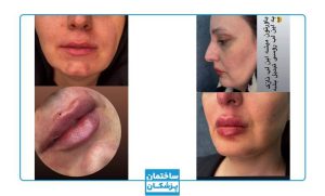 نمونه کار زیبایی کلینیک دلدار