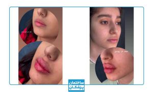 نمونه کار زیبایی کلینیک دلدار1