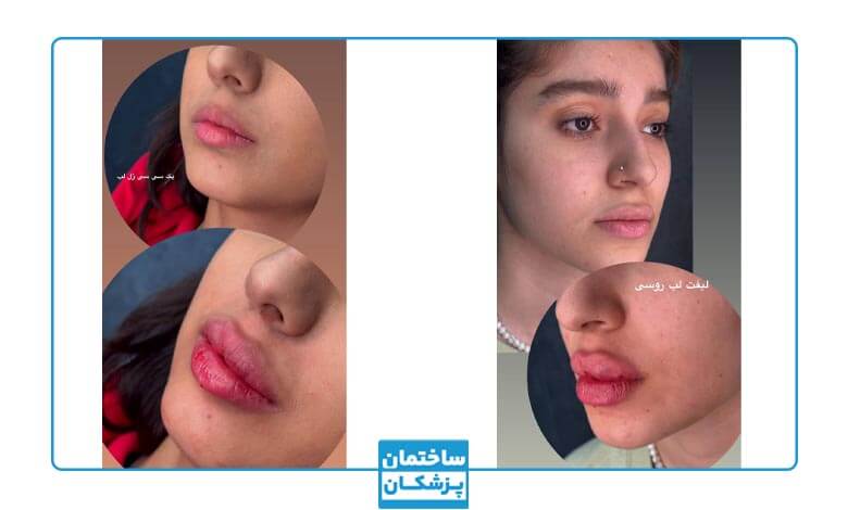 نمونه کار زیبایی کلینیک دلدار1