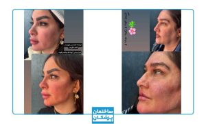 نمونه کار زیبایی کلینیک دلدار