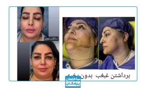 نمونه کار زیبایی کلینیک دلدار3