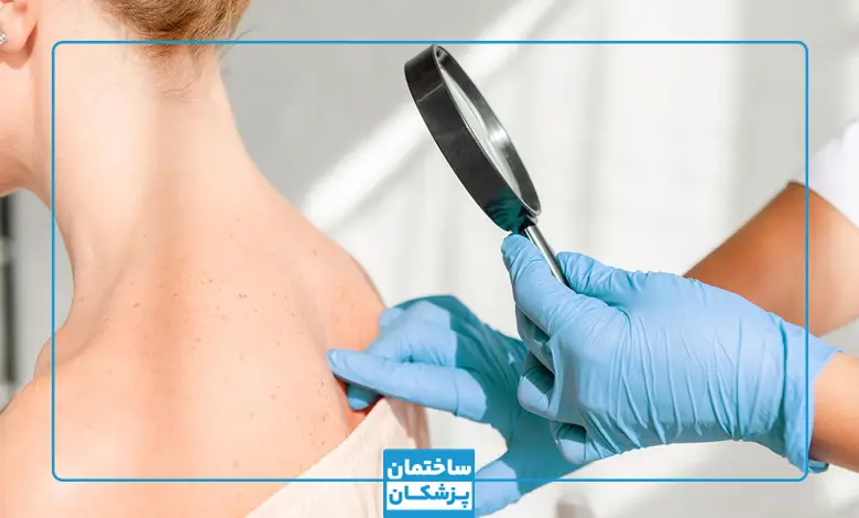 بهترین دکتر پوست اصفهان