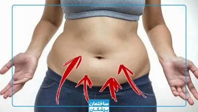 بهترین دکتر ابدومینوپلاستی در تهران