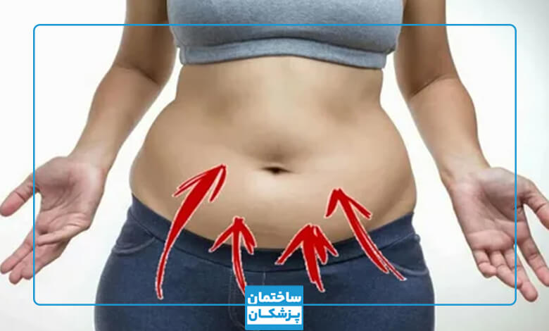 بهترین دکتر ابدومینوپلاستی در تهران