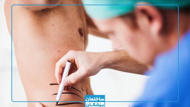 بهترین دکتر پیکر تراشی در تهران