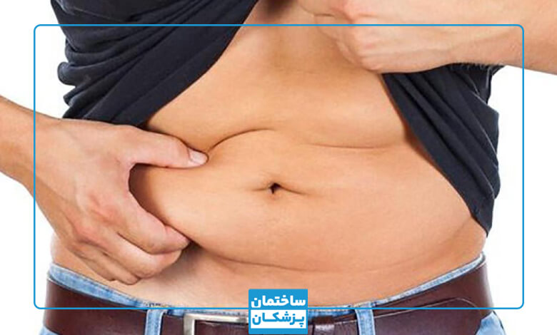 معیارهای انتخای بهترین دکتر ابدومینوپلاستی