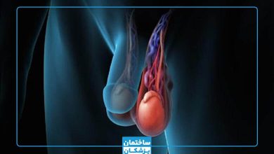 بهترین دکتر واریکوسل در تهران