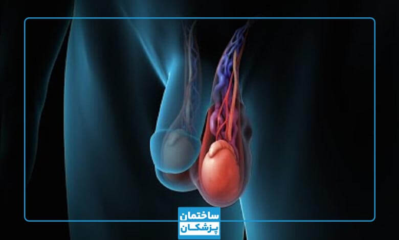 بهترین دکتر واریکوسل در تهران