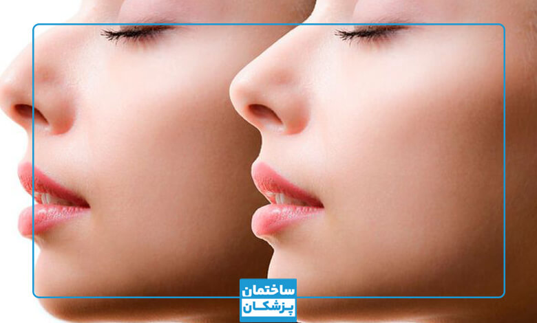 هزینه های قبل از عمل بینی