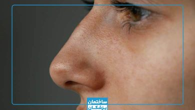 کوچک شدن بینی در خانه