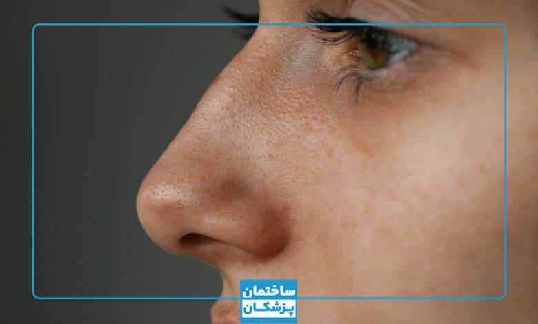 کوچک شدن بینی در خانه