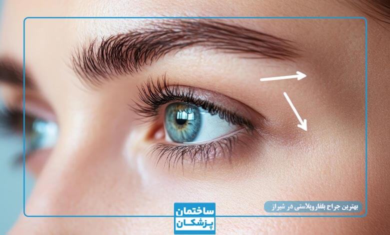 معیارهای مهم در انتخاب بهترین جراح زیبایی پلک