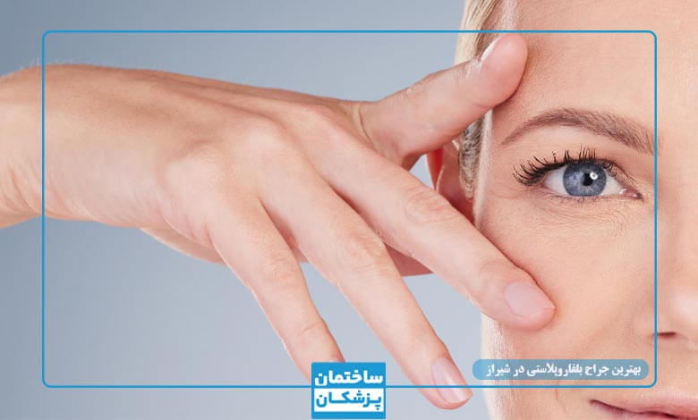 مشخصات بهترین جراح زیبایی پلک در شیراز