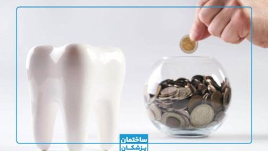قیمت انواع ایمپلنت در تهران