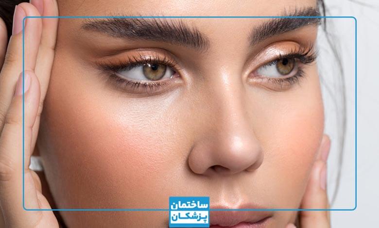 روش های لیفت شقیقه چیست