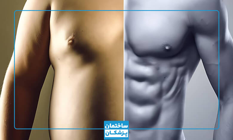 بهترین کاندیدای برای پیکرتراشی در مشهد