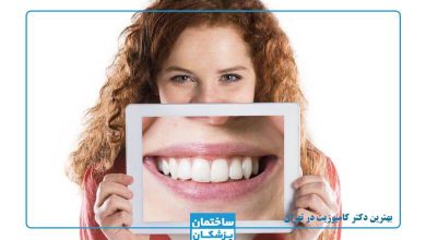 بهترین دکتر کامپوزیت در تهران