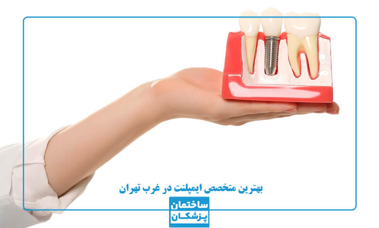 مشخصات بهترین متخصص ایمپلنت در غرب تهران