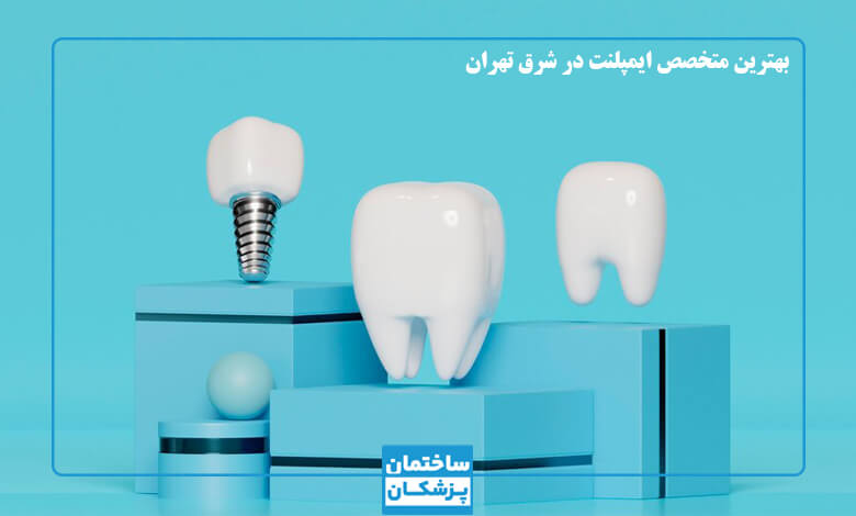 پیدا کردن متخصص ایمپلنت در شرق تهران