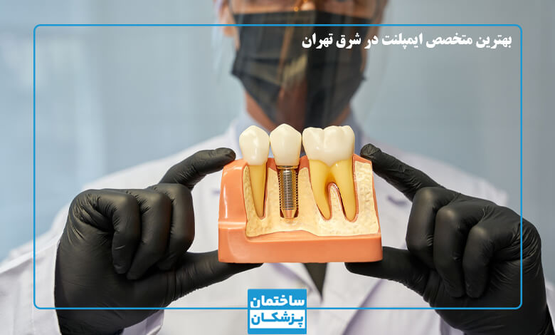 بهترین متخصص ایمپلنت در شرق تهران