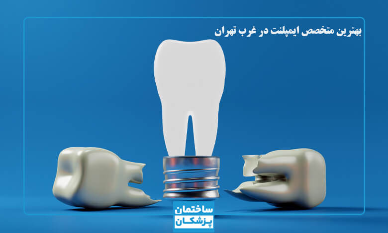 لیست بهترین متخصصین ایمپلنت در غرب تهران