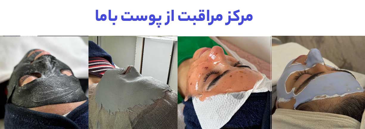 نمونه کار فیشیال پوست در کلینیک باما